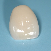 栃木県宇都宮市ハートフルにわの歯科医院 審美歯科デンタルエステ